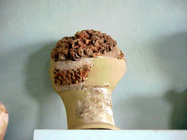 Votive Offerings to Asklepios (4)