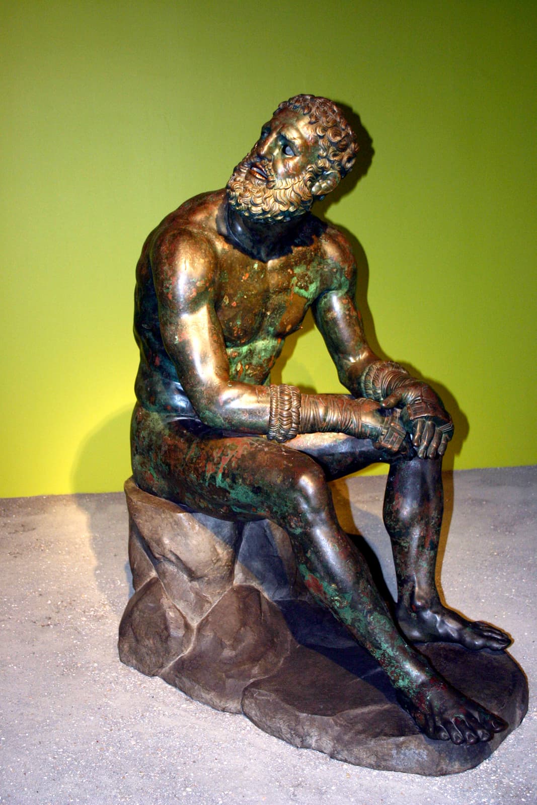Boxer at Rest (Front)